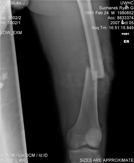 Name:  femur.jpg
Views: 8
Size:  24.2 KB